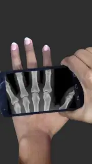 X Ray Scanner Pro скриншот 2